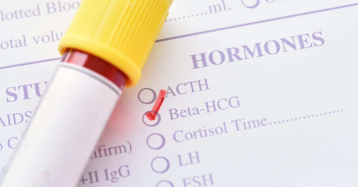 Beta HCG Nedir? Hafta Hafta Gebelikte HCG Değerleri ve Yorumları kapak resmi