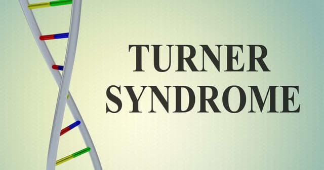 Turner Sendromu Nedir? image