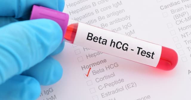 Beta HCG Nedir? image